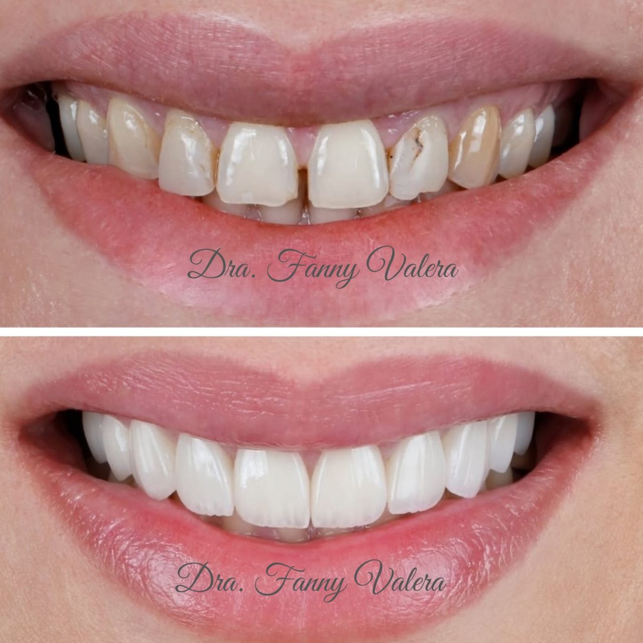 Fanny Valera Velásquez-3