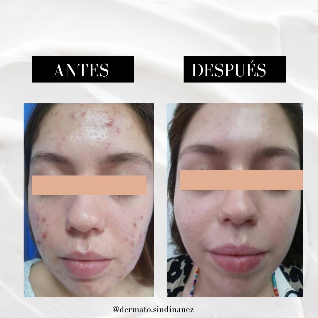 Sindi Lorena Ñañez Aguirre-6