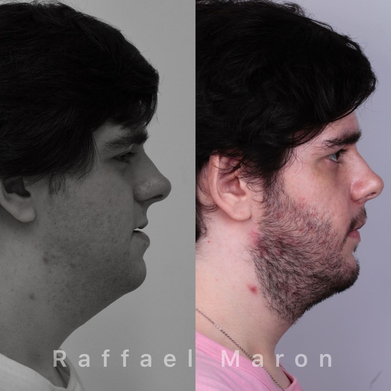 Raffael Maron Vieira De Noronha-8