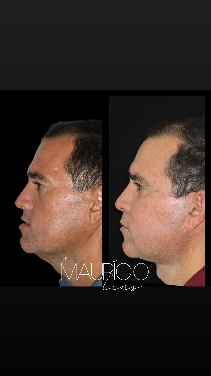 Mauricio Lins Moura-6