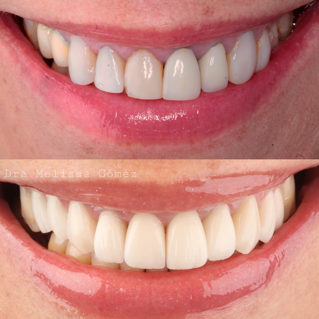 Melissa Gómez Arango-7