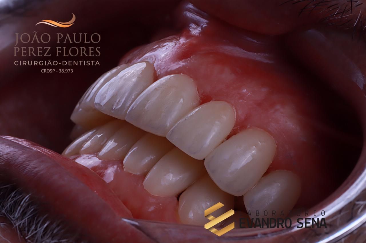 Joao Paulo  Perez Flores-2