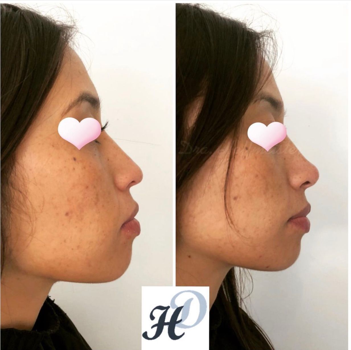 Daniela Hoffmeister-3