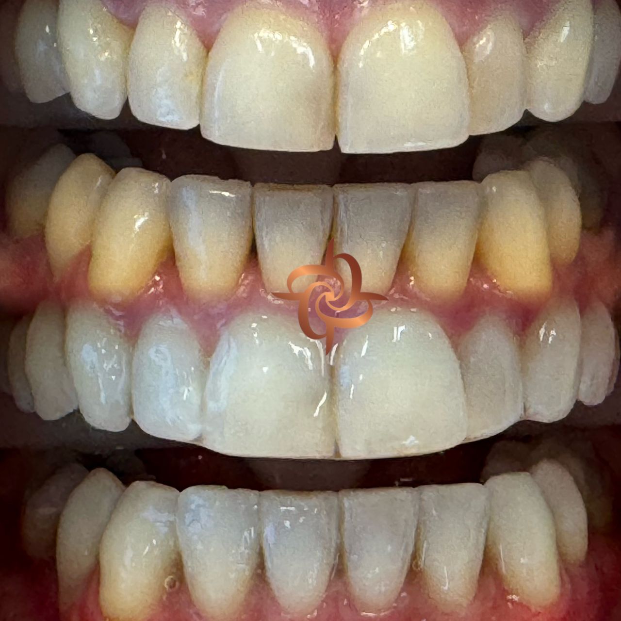 Gisele De Carvalho Versannio-6