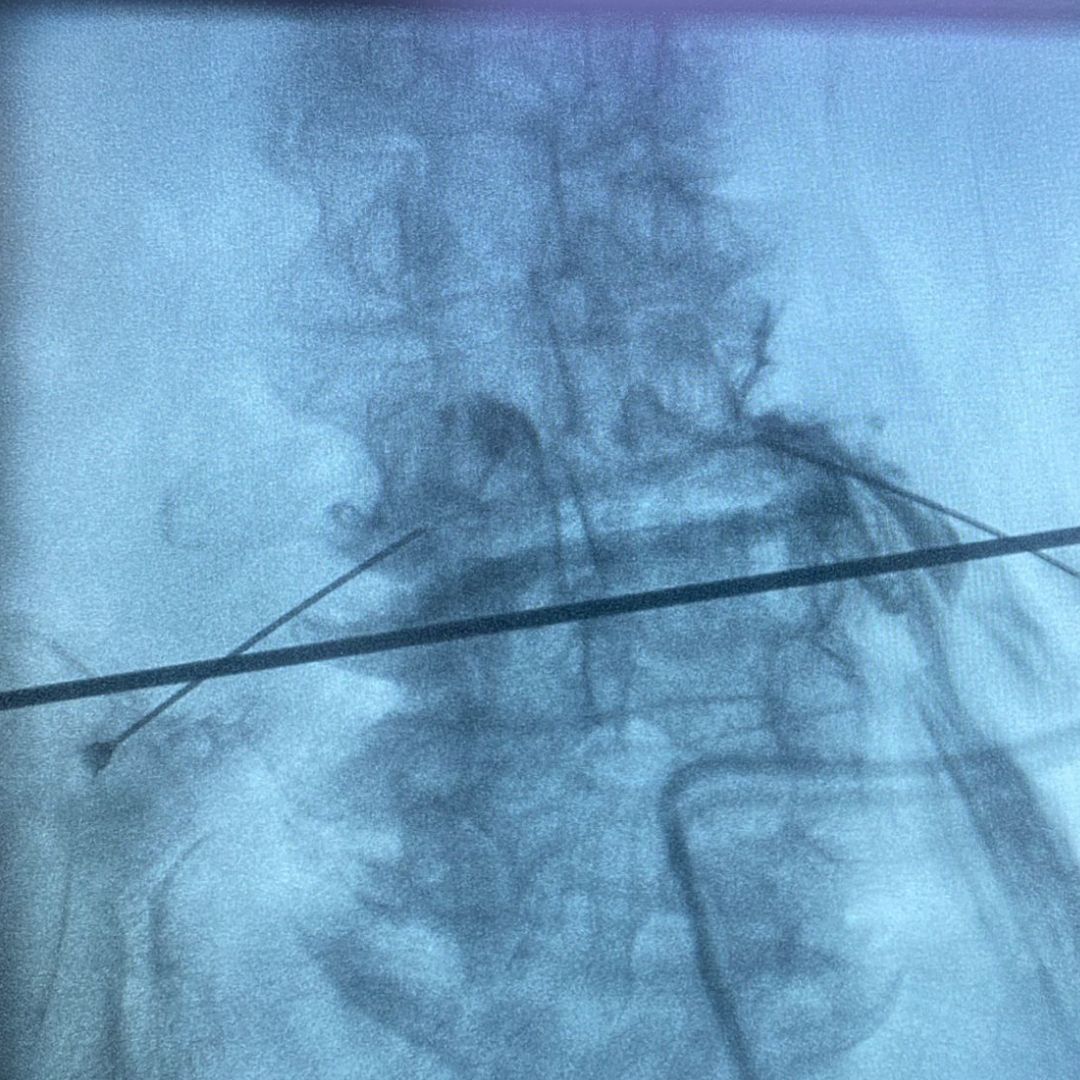 David Tafur Muñoz-2139