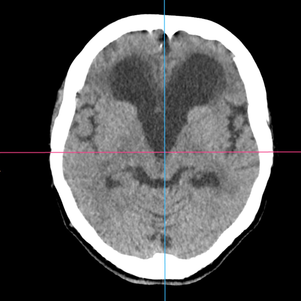 David Tafur Muñoz-2023