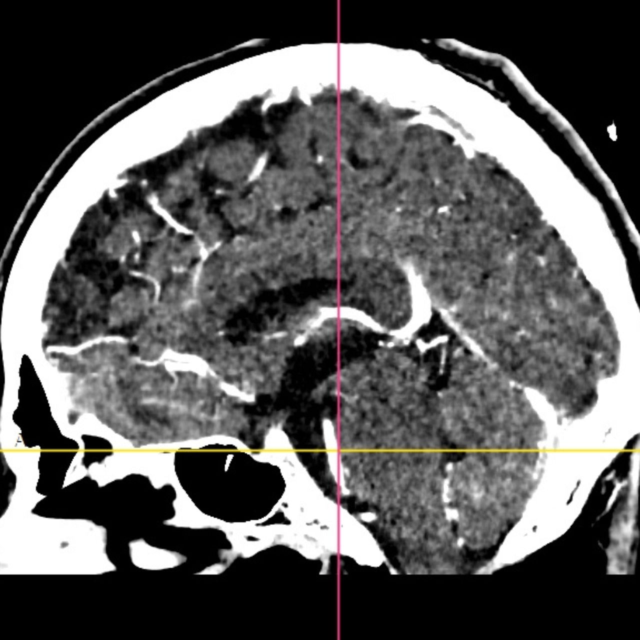 David Tafur Muñoz-1453