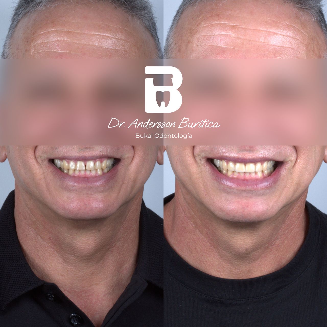 Andersson Buritica-4