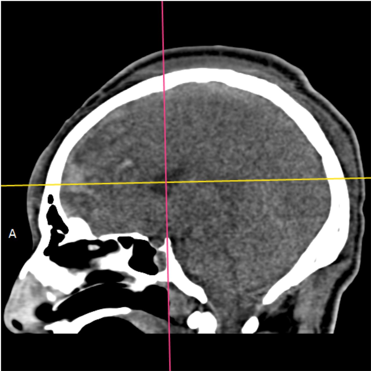 David Tafur Muñoz-1951