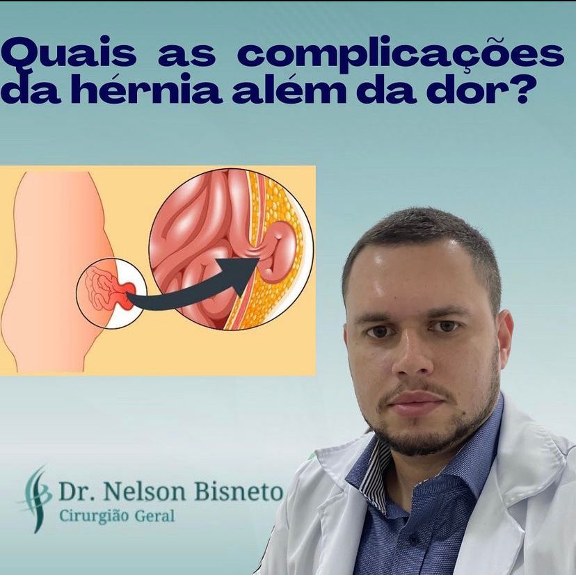 Nelson Bisneto-100