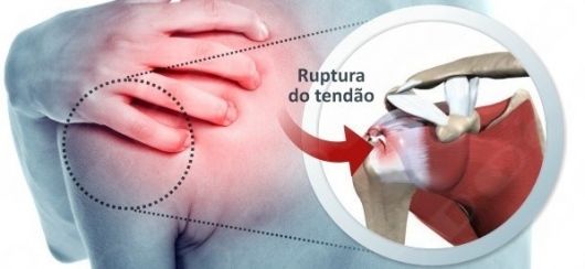 Leonardo De Souza Ribeiro-1