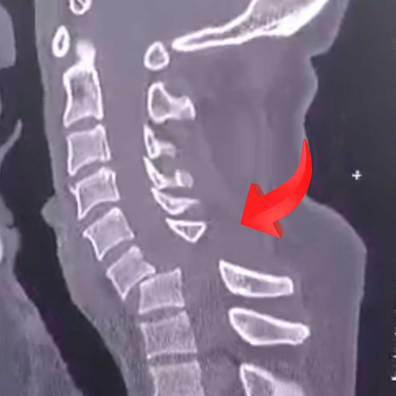 David Tafur Muñoz-2099