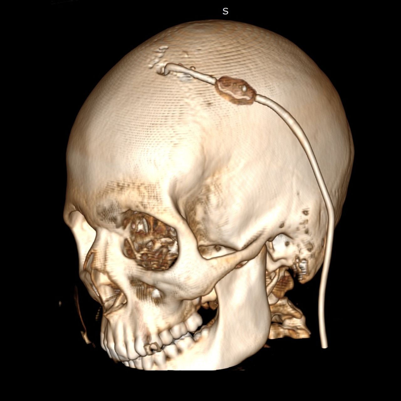 David Tafur Muñoz-1189