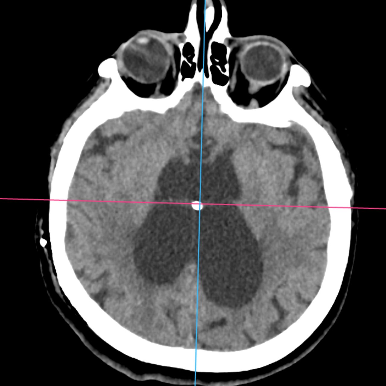David Tafur Muñoz-1933