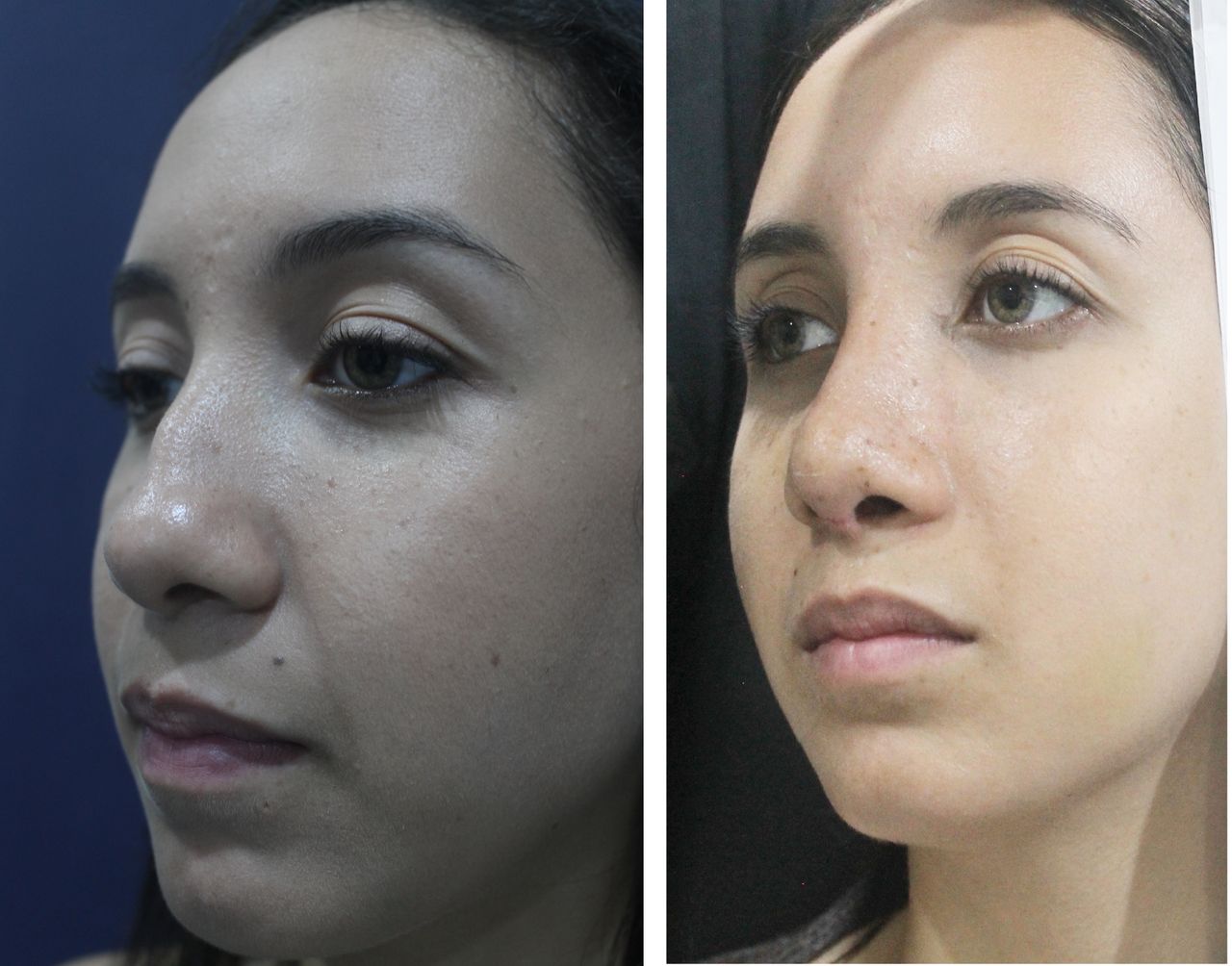 Jorge A Holguin Ruiz-19