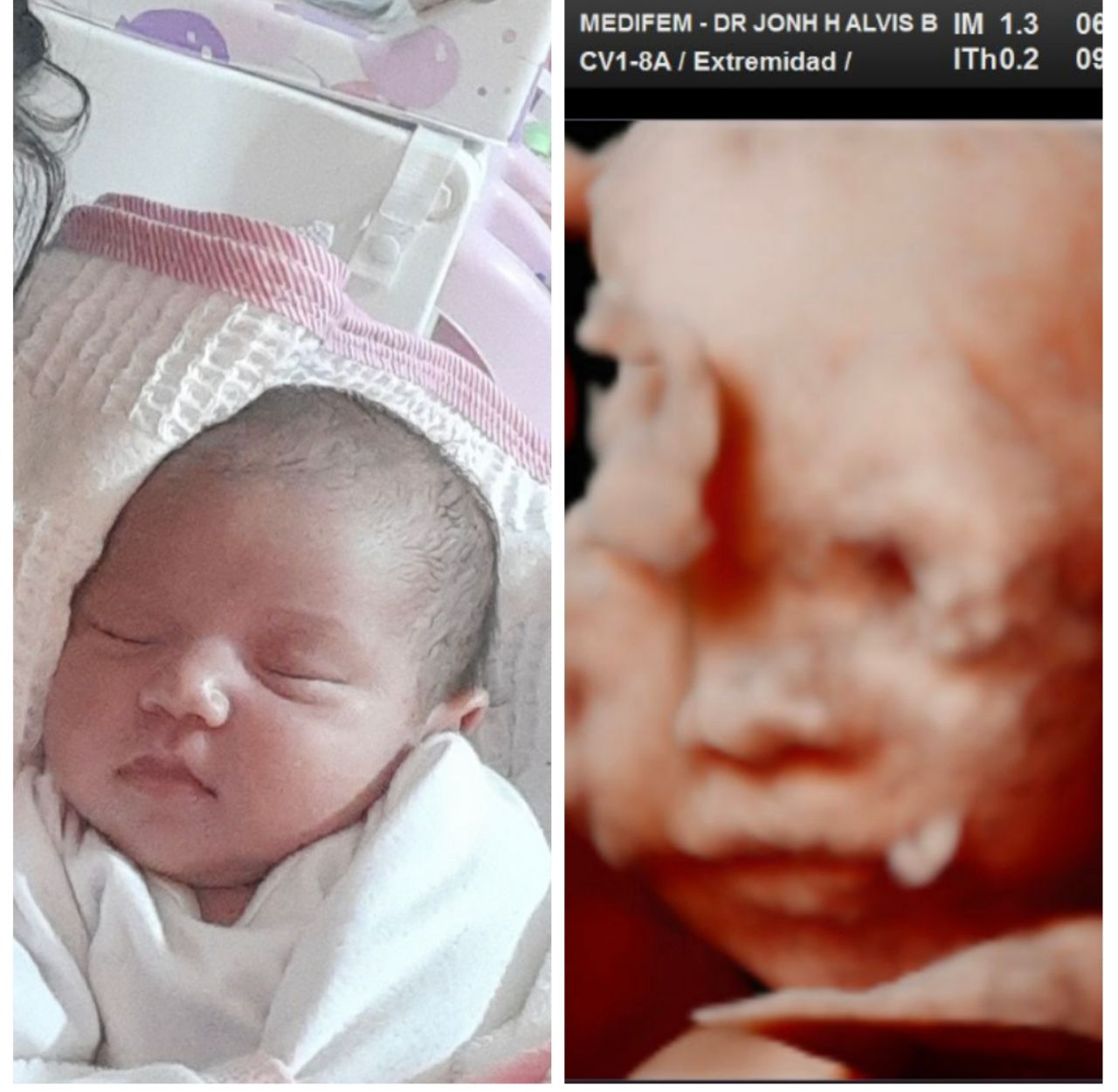 Jonh Harold Alvis Botello-7