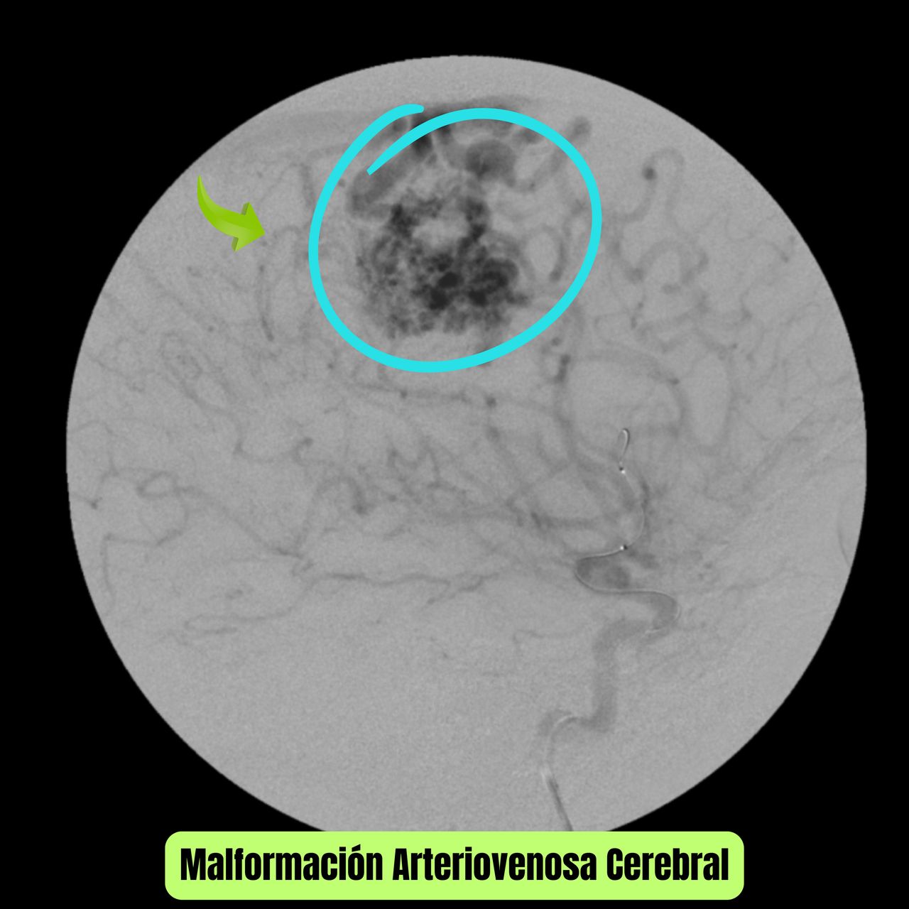 David Tafur Muñoz-1713