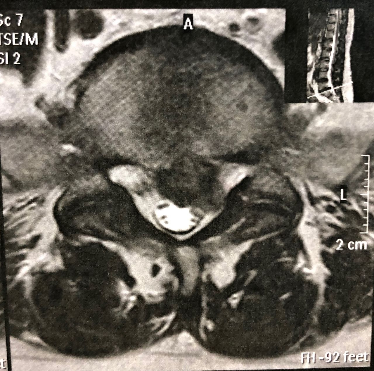 José Lopes Sousa Filho-36