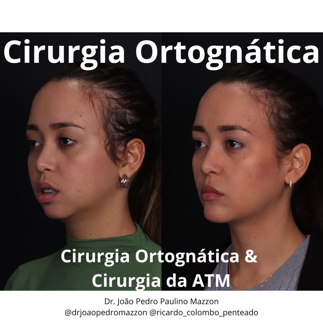 João Pedro Paulino Mazzon-35