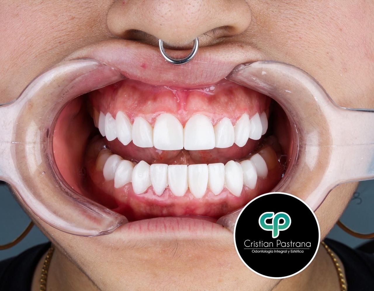 Cristian Pastrana Corrales-6