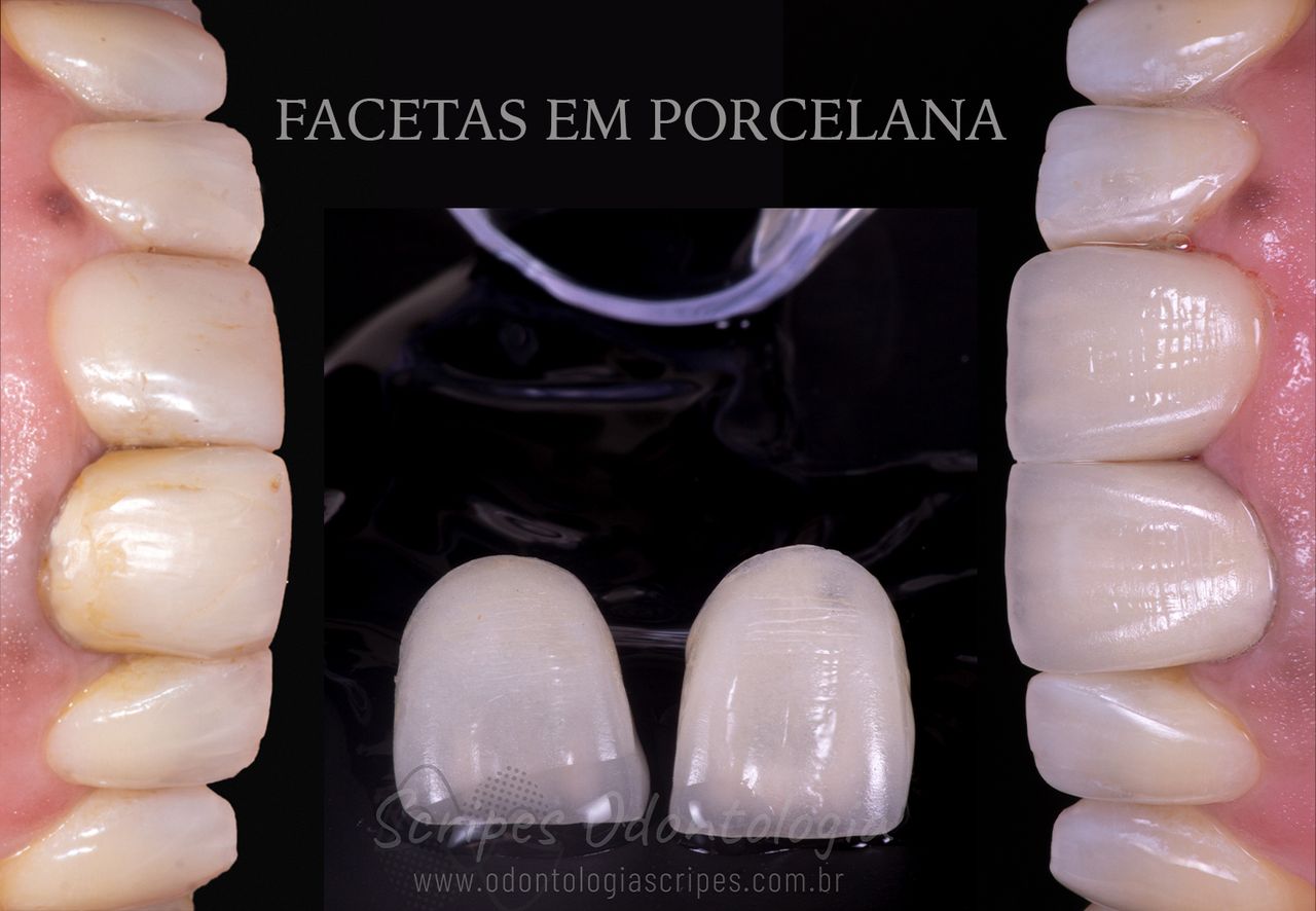 Gabriel Godoy Scripes-74