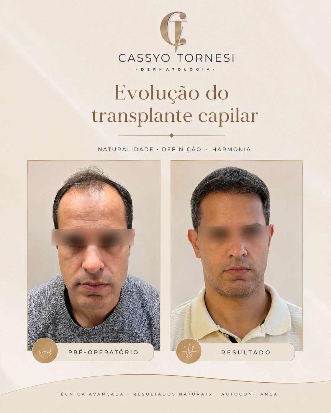 Cassyo Tornesi-14