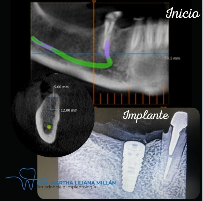 Martha Liliana Millan Diaz-35