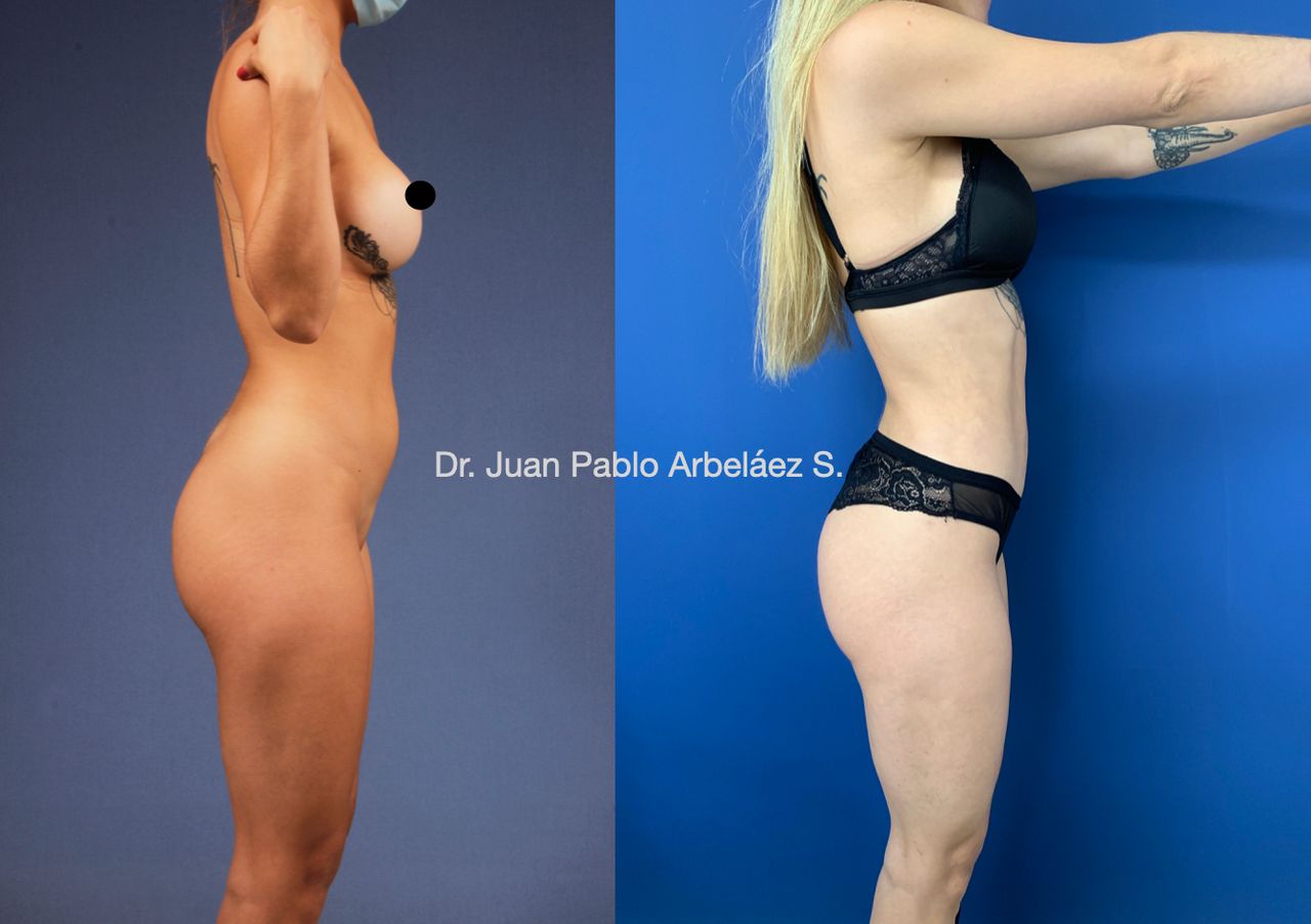 Juan Pablo Arbeláez Sierra-23