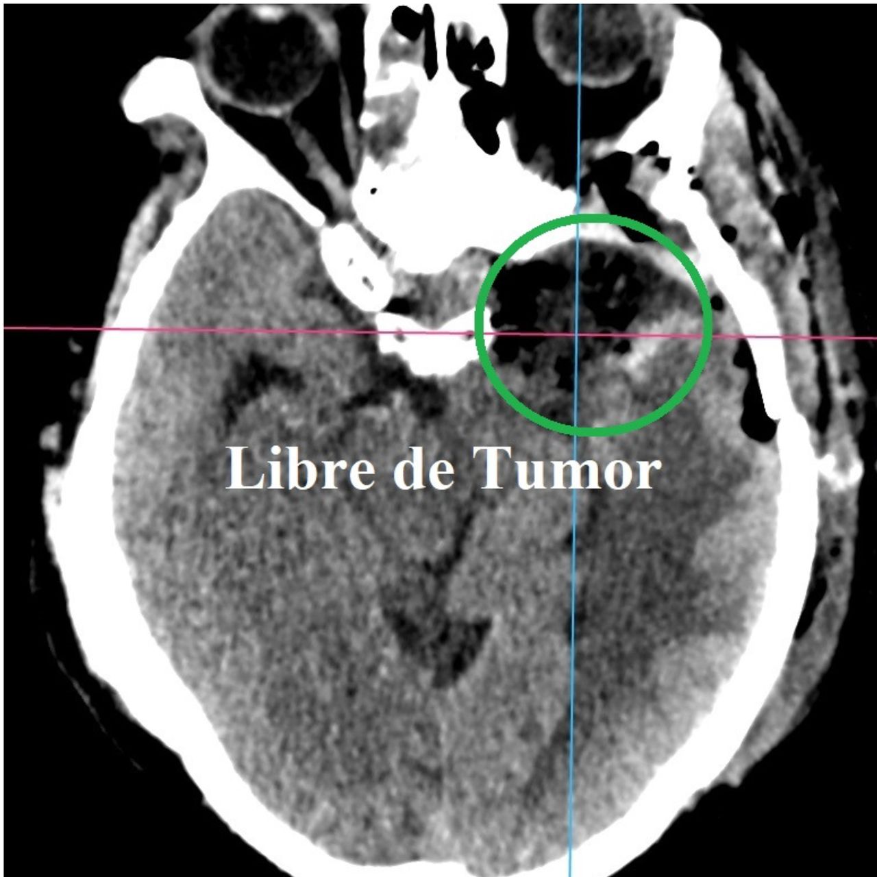 David Tafur Muñoz-1354