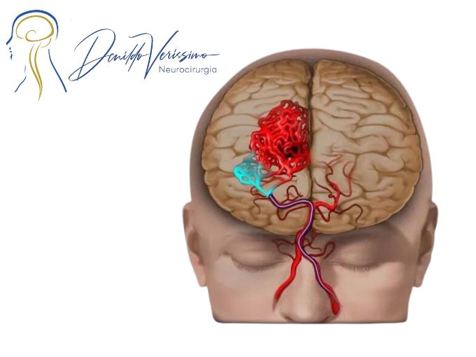 Denildo Veríssimo-24