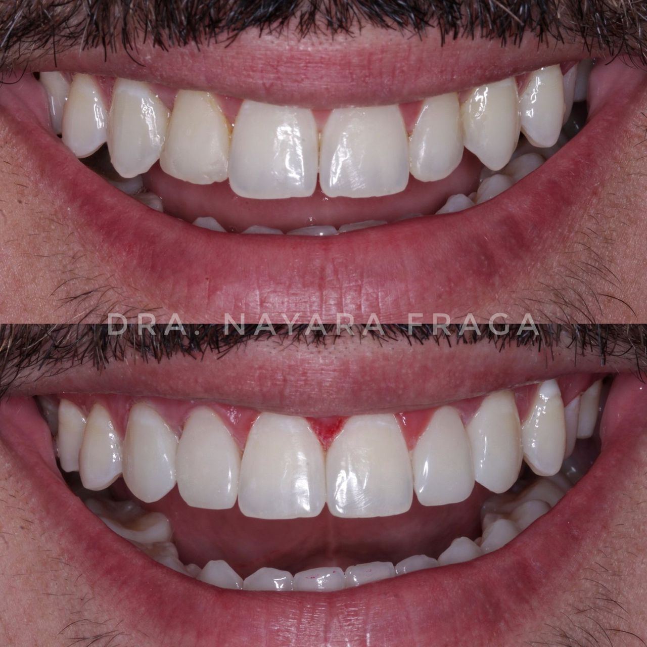 Nayara Fraga De Miranda-6