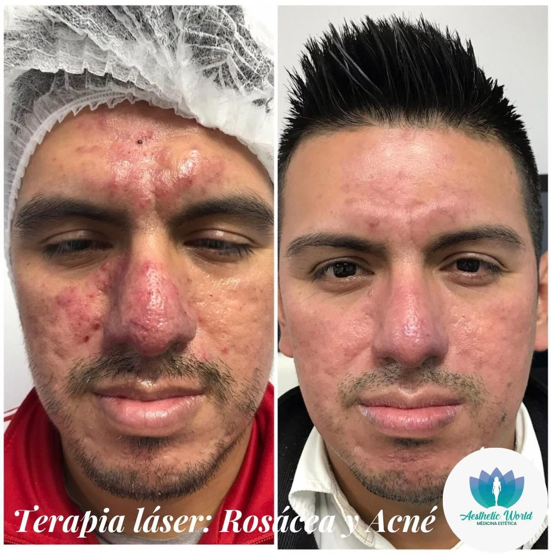 Jhonatan Oyola Farfán-27