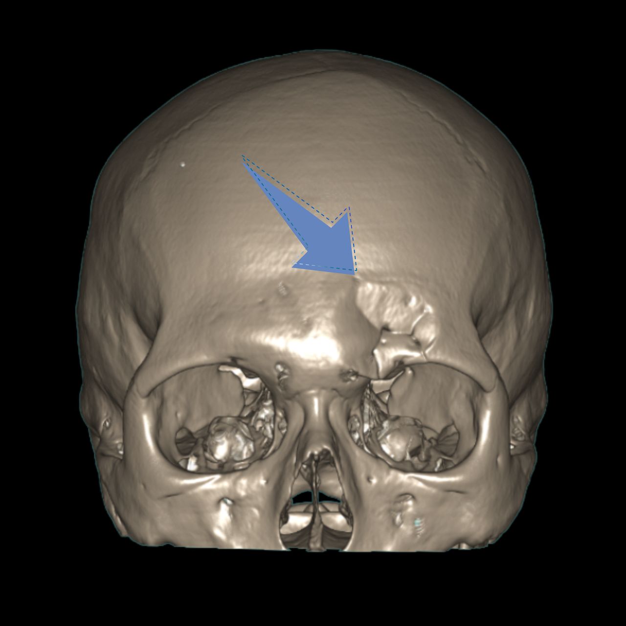 David Tafur Muñoz-1328