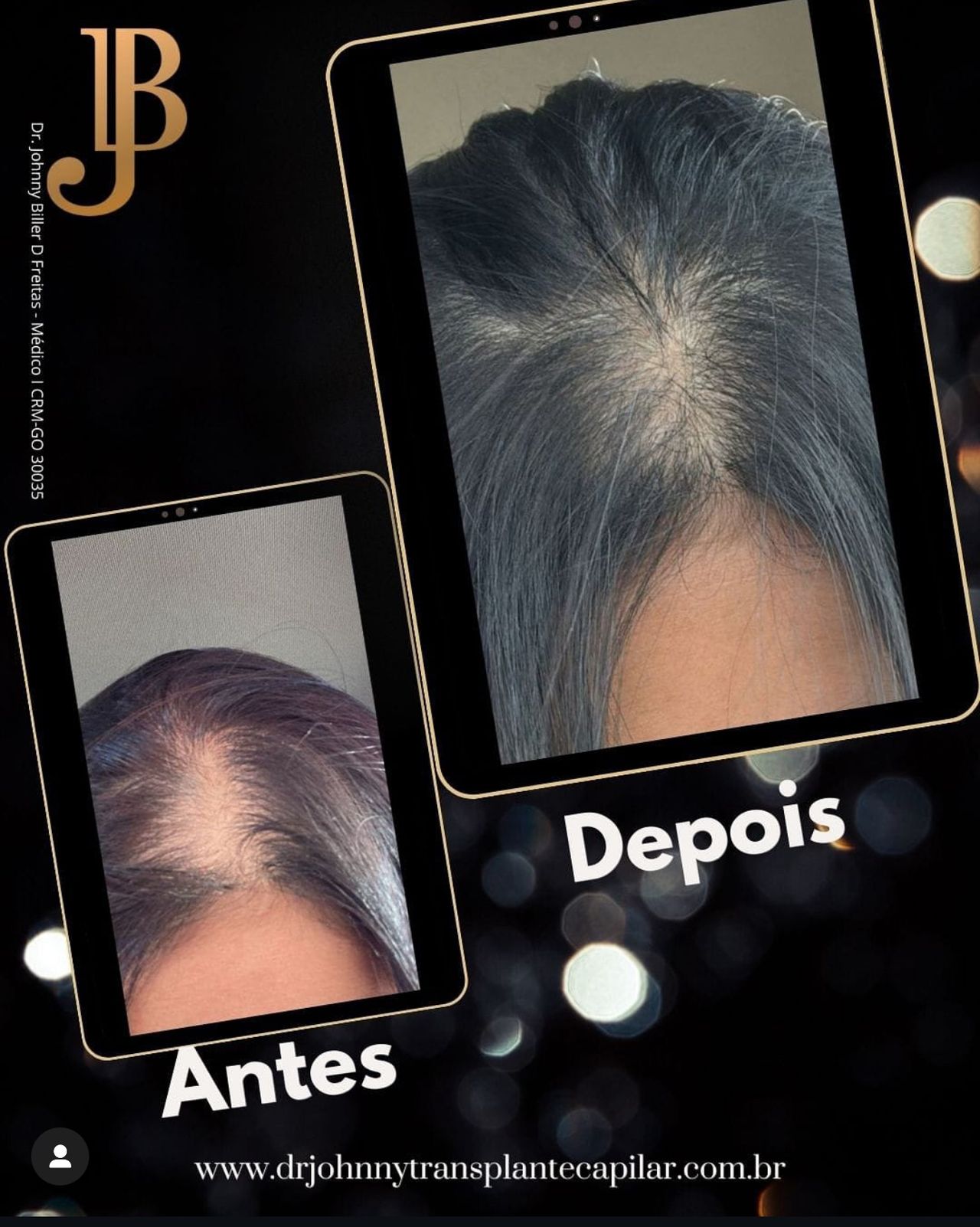 Johnny Biller  Dias Freitas -0