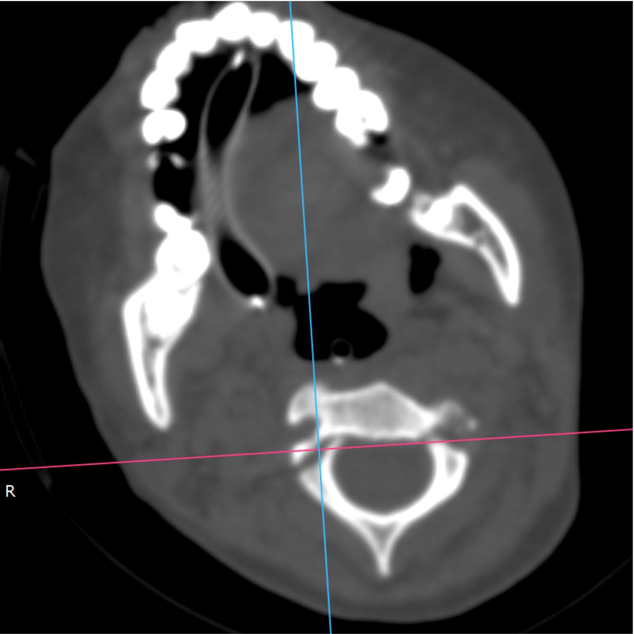 David Tafur Muñoz-2203