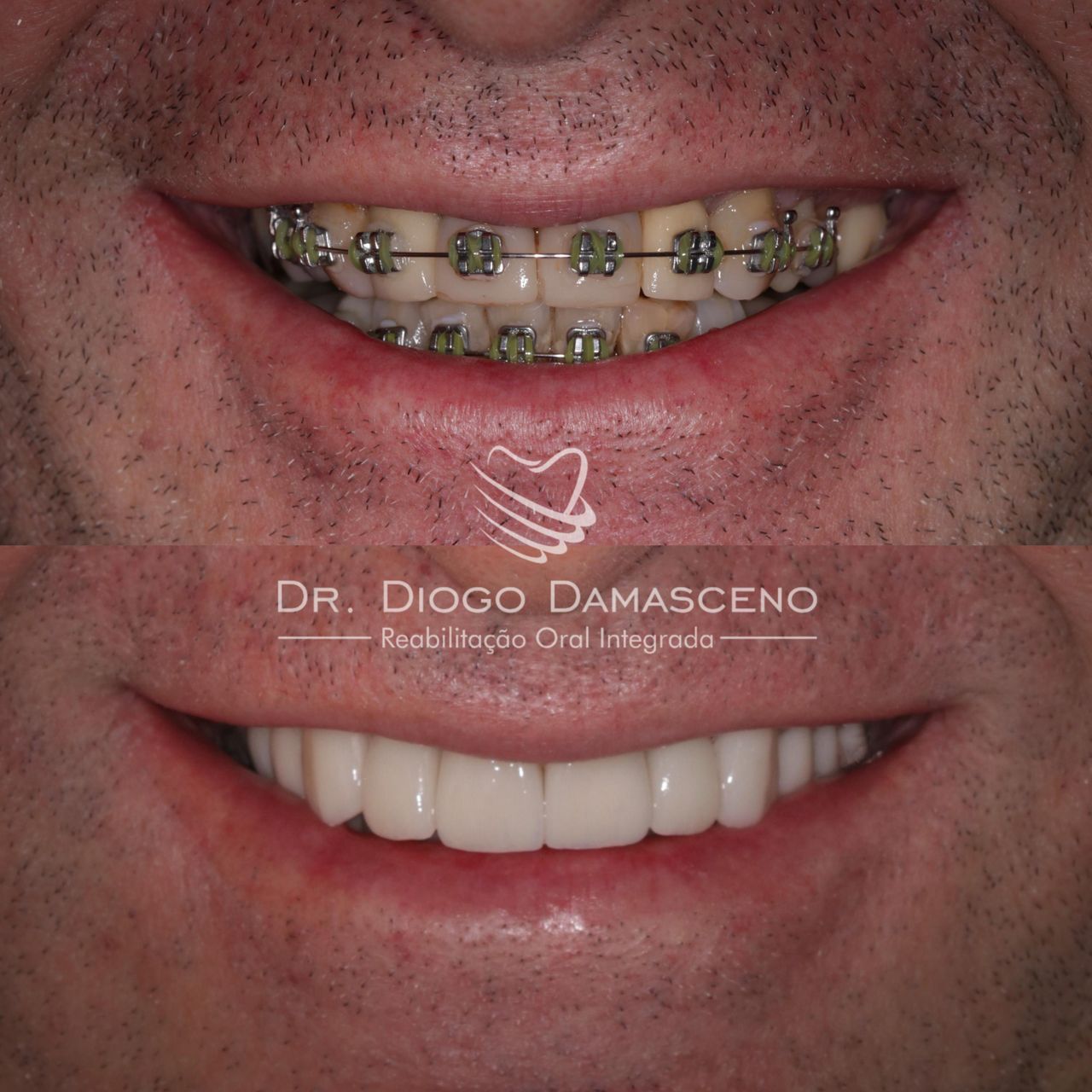 Diogo Damasceno-6