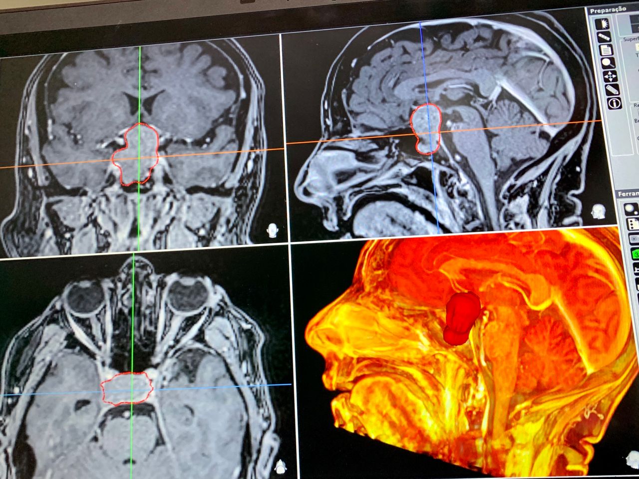 Rafael Meirelles .-1