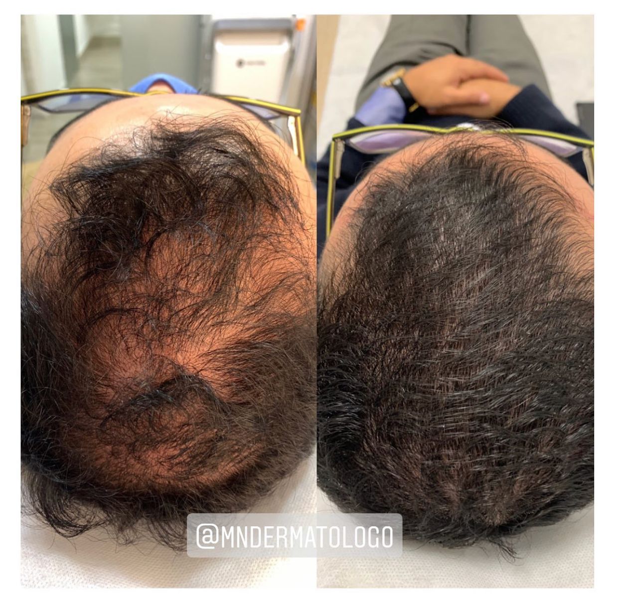 Mario Naranjo Otero-4