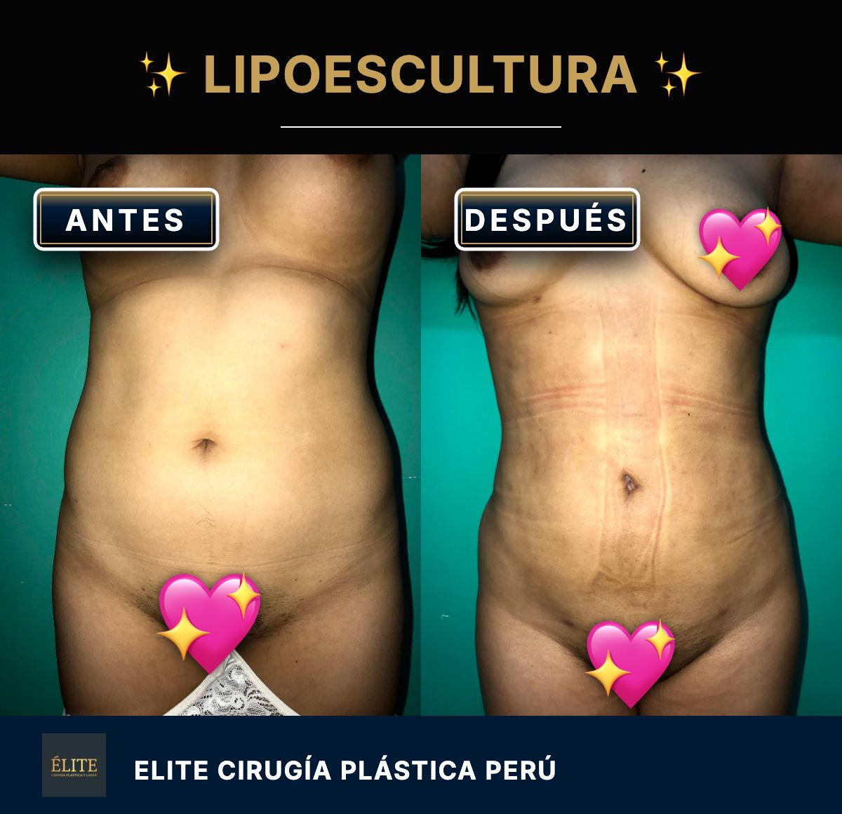 Roberto Alexander Rodriguez Zuñiga-8