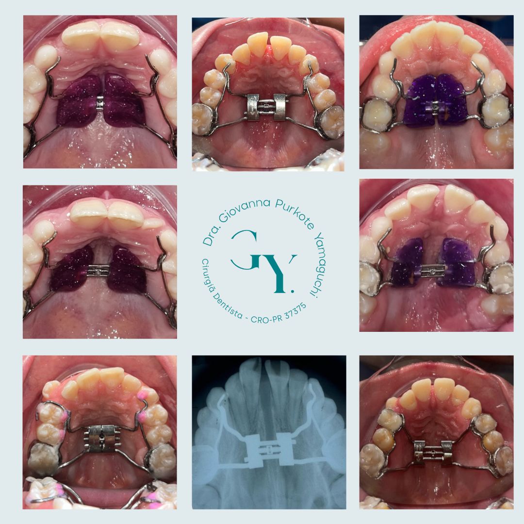 Giovanna Purkote Yamaguchi-1