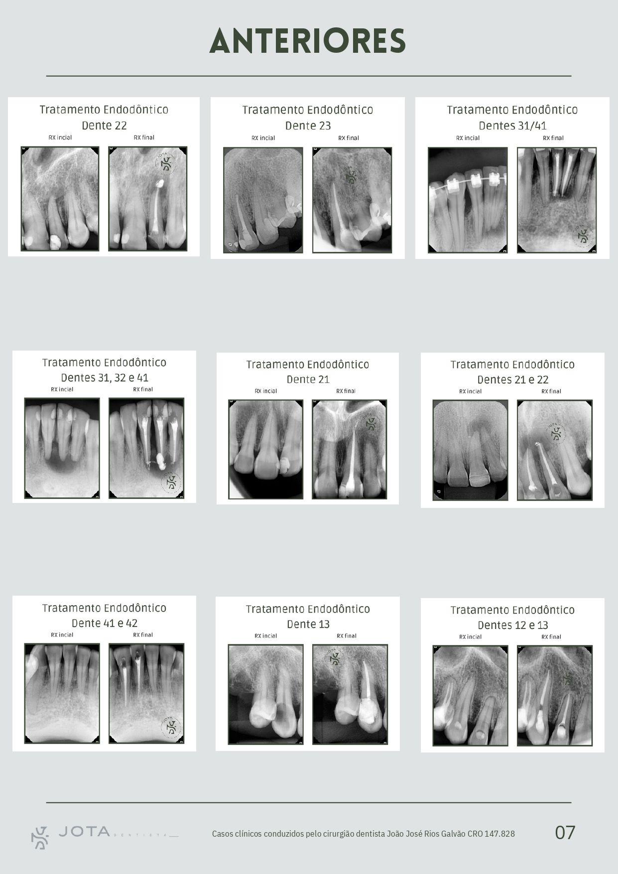 João  Rios Galvão-7