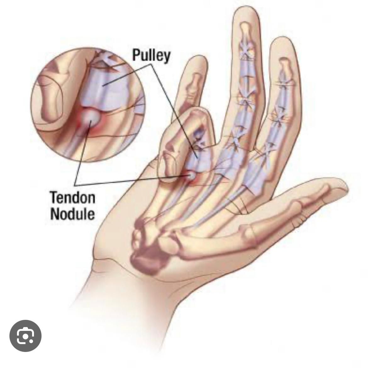 Jônatas Laurindo Giacomini-31