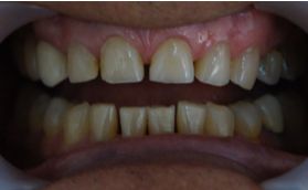 Jhoan Felipe León Correa-4