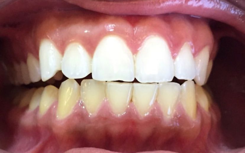 Leandro Ponte Dias-41