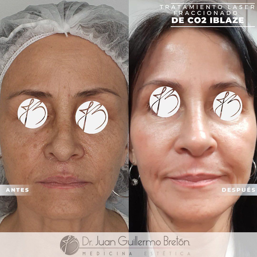 Juan Guillermo Bretón Franco-4