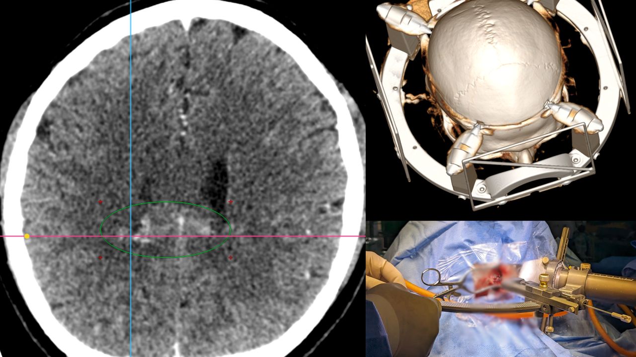 David Tafur Muñoz-1989