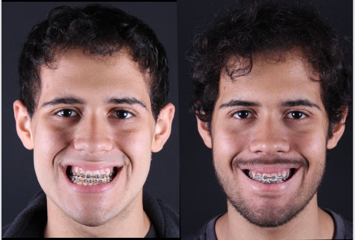 Frederico Carnevale-14