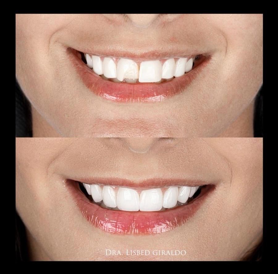 Lisbed Giraldo Olarte-28