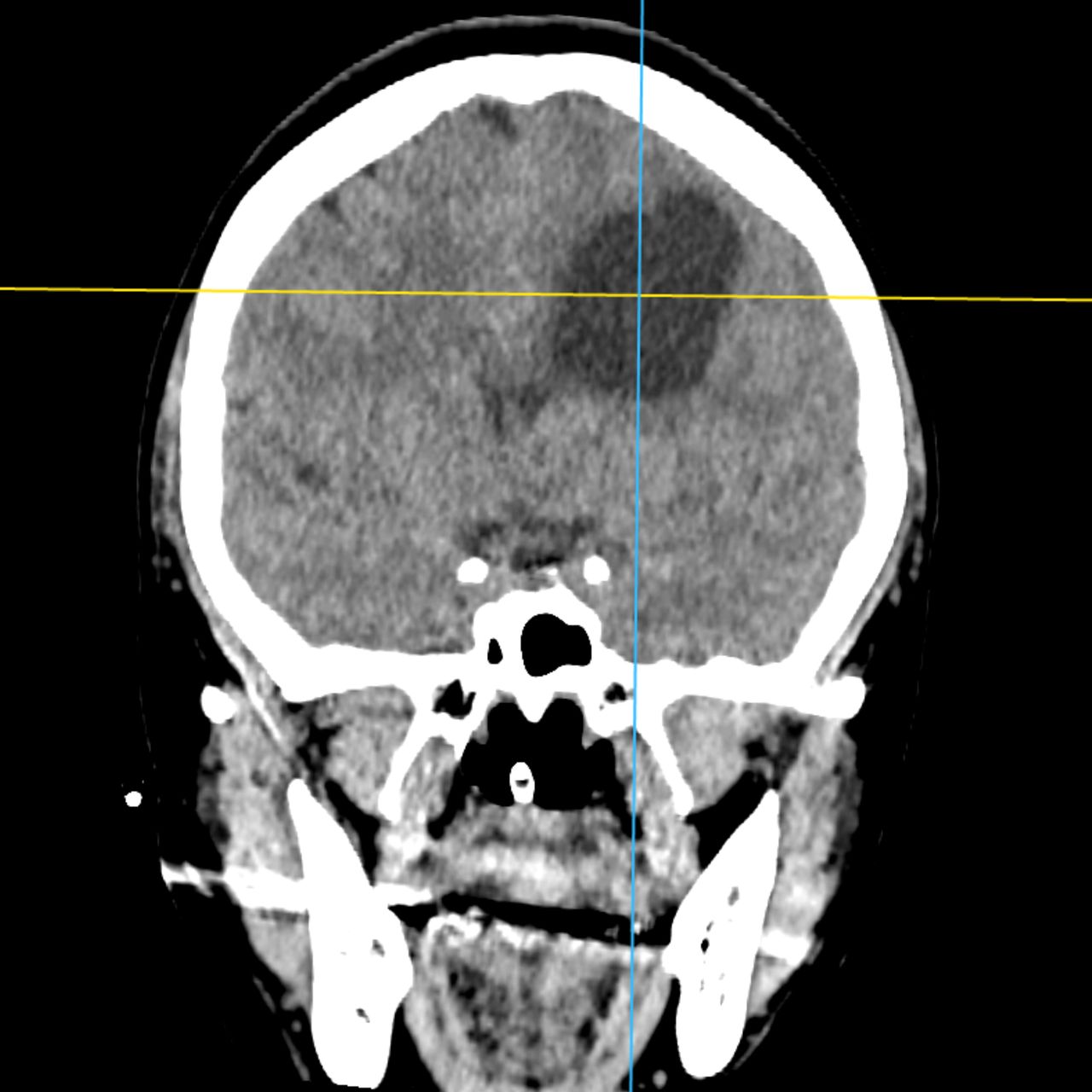 David Tafur Muñoz-1922