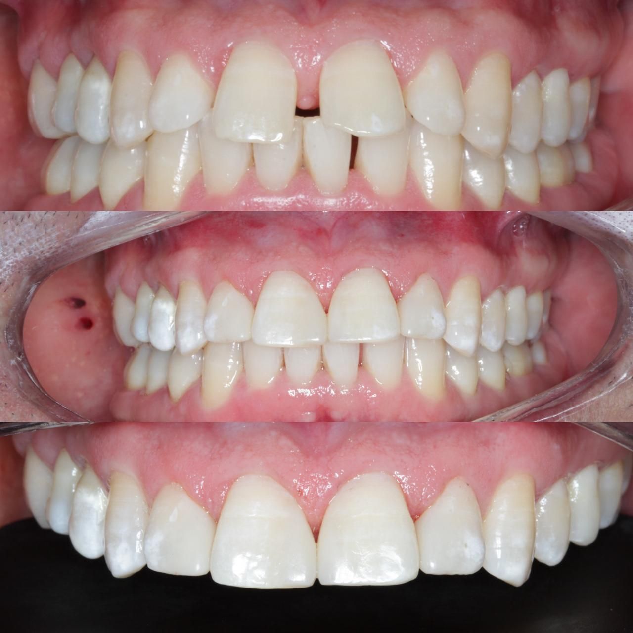 Antônio Alegria Do Nascimento-7